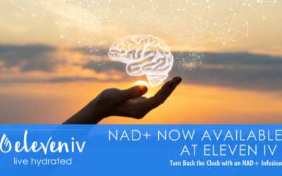 What is NAD+